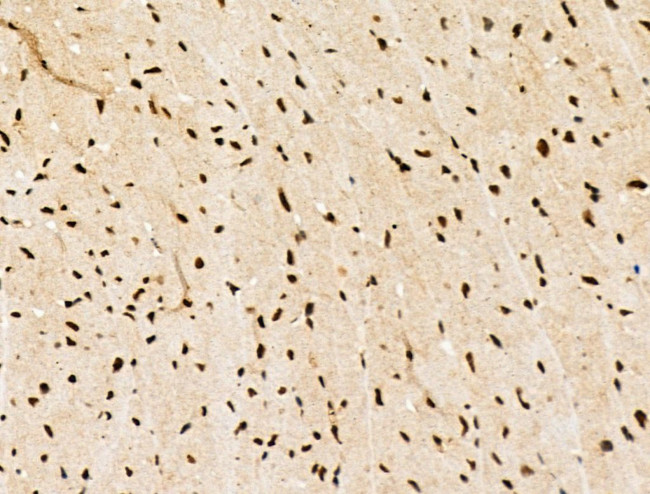 Galectin 7 Antibody in Immunohistochemistry (Paraffin) (IHC (P))