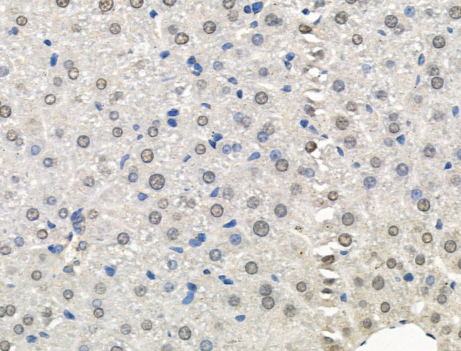 Galectin 7 Antibody in Immunohistochemistry (Paraffin) (IHC (P))