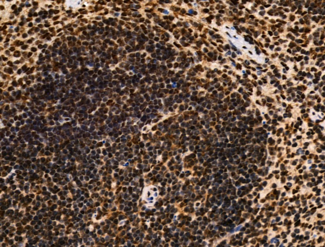 Galectin 7 Antibody in Immunohistochemistry (Paraffin) (IHC (P))