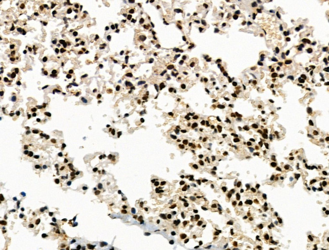 Galectin 7 Antibody in Immunohistochemistry (Paraffin) (IHC (P))