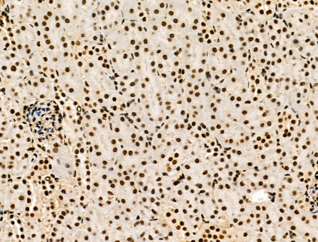 Galectin 7 Antibody in Immunohistochemistry (Paraffin) (IHC (P))