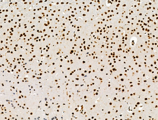 Galectin 7 Antibody in Immunohistochemistry (Paraffin) (IHC (P))