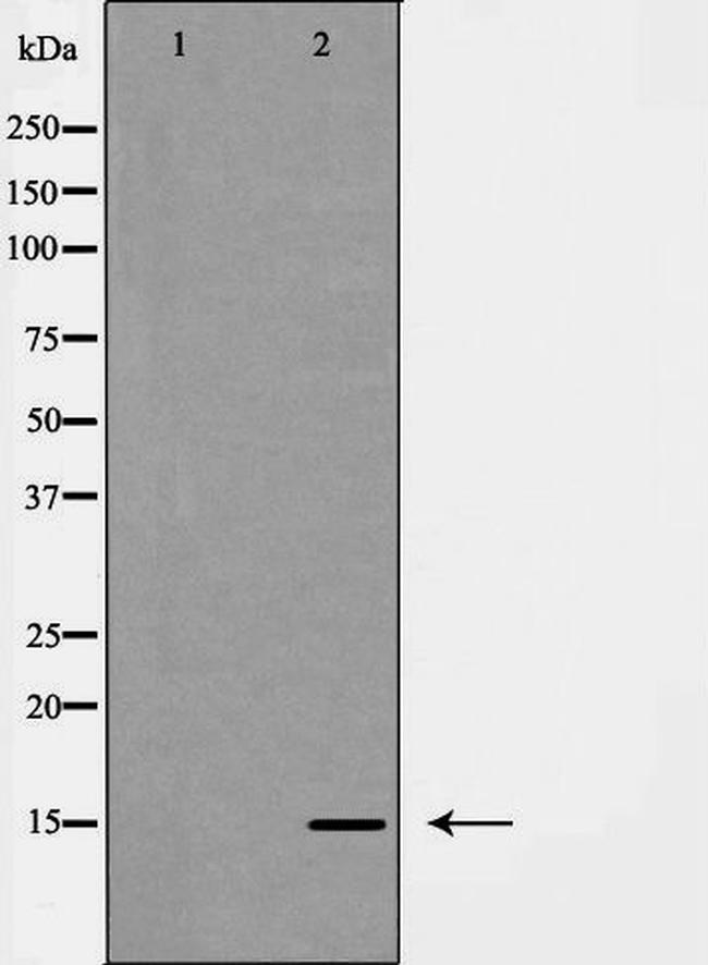 Galectin 7 Antibody in Western Blot (WB)