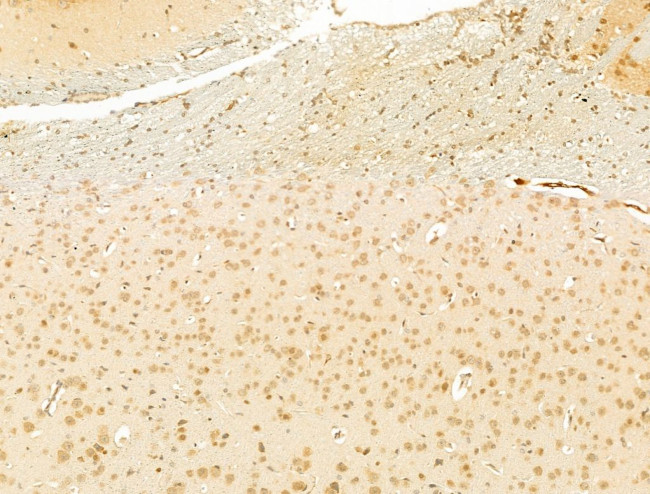 LHX6 Antibody in Immunohistochemistry (Paraffin) (IHC (P))