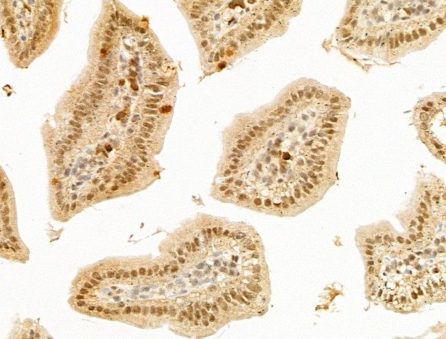 LHX6 Antibody in Immunohistochemistry (Paraffin) (IHC (P))