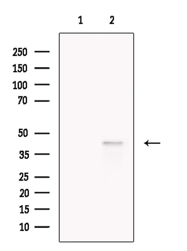 LHX6 Antibody in Western Blot (WB)