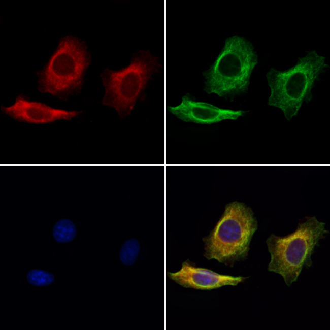 LIF Antibody in Immunocytochemistry (ICC/IF)