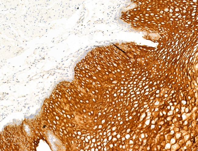 LIF Antibody in Immunohistochemistry (Paraffin) (IHC (P))