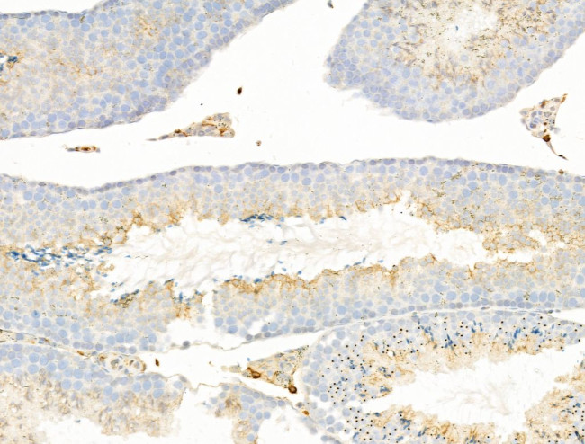 LIF Antibody in Immunohistochemistry (Paraffin) (IHC (P))