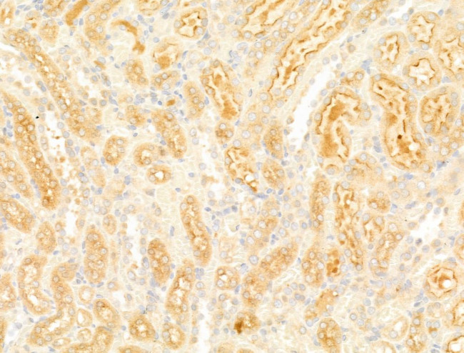 LIF Antibody in Immunohistochemistry (Paraffin) (IHC (P))