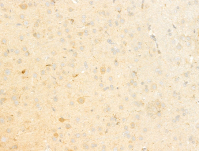 LIF Antibody in Immunohistochemistry (Paraffin) (IHC (P))