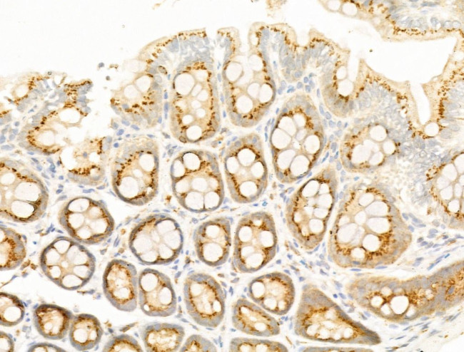 LIF Antibody in Immunohistochemistry (Paraffin) (IHC (P))