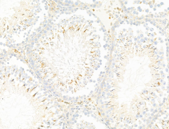 LIF Antibody in Immunohistochemistry (Paraffin) (IHC (P))