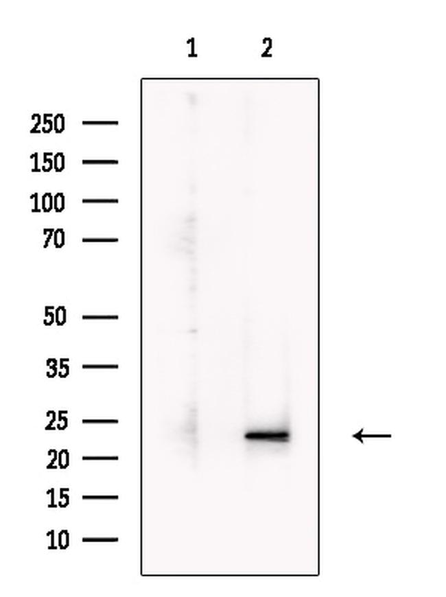 LIF Antibody in Western Blot (WB)