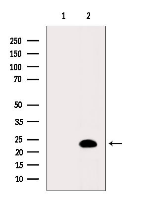 LIF Antibody in Western Blot (WB)