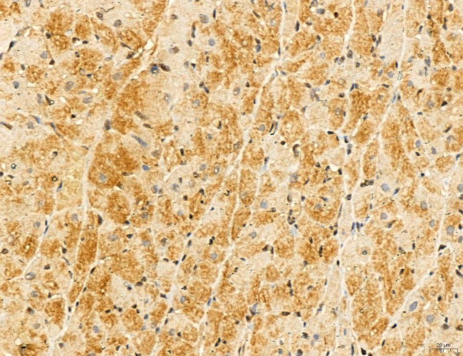 LIFR Antibody in Immunohistochemistry (Paraffin) (IHC (P))