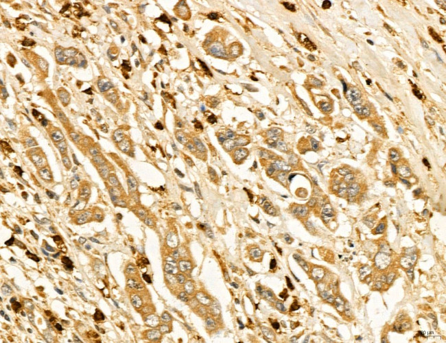 LIFR Antibody in Immunohistochemistry (Paraffin) (IHC (P))