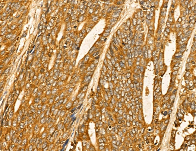 LIFR Antibody in Immunohistochemistry (Paraffin) (IHC (P))