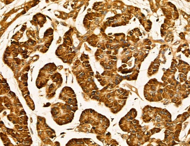 LIFR Antibody in Immunohistochemistry (Paraffin) (IHC (P))