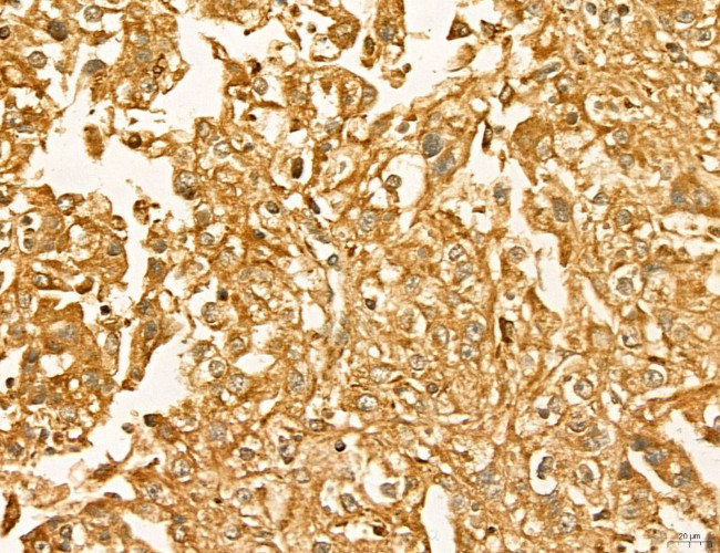 LIFR Antibody in Immunohistochemistry (Paraffin) (IHC (P))