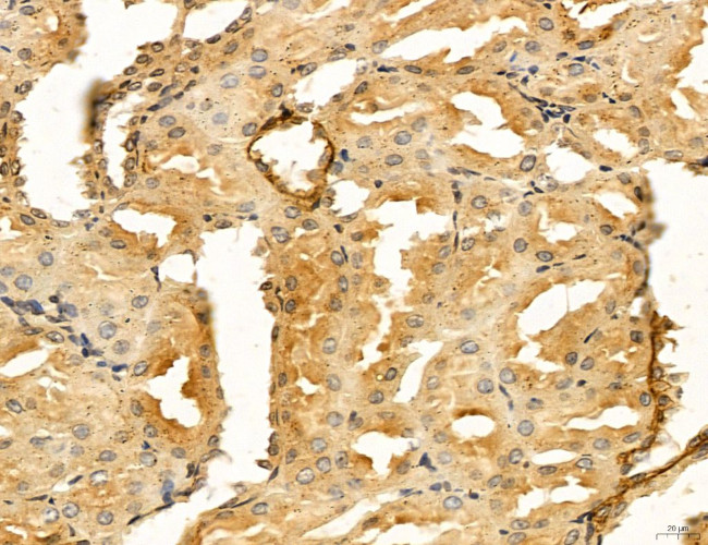 LIFR Antibody in Immunohistochemistry (Paraffin) (IHC (P))