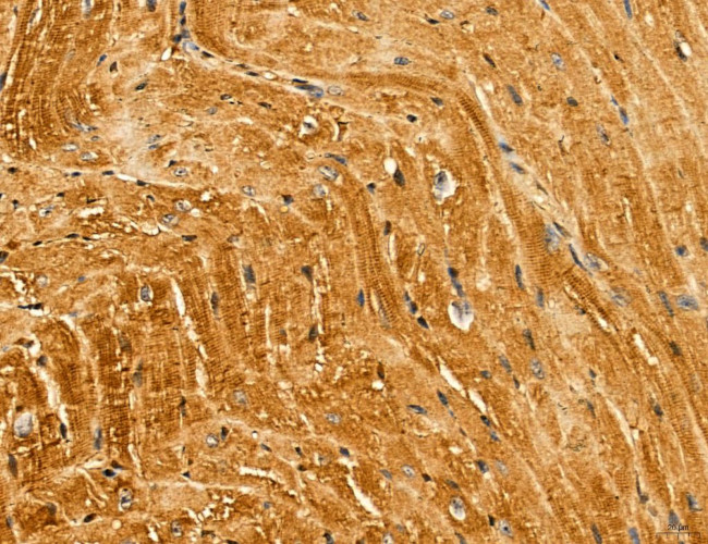 LIFR Antibody in Immunohistochemistry (Paraffin) (IHC (P))