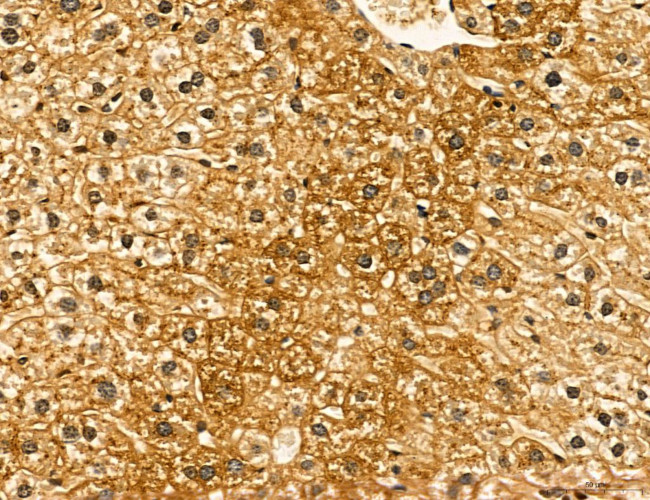 LIFR Antibody in Immunohistochemistry (Paraffin) (IHC (P))