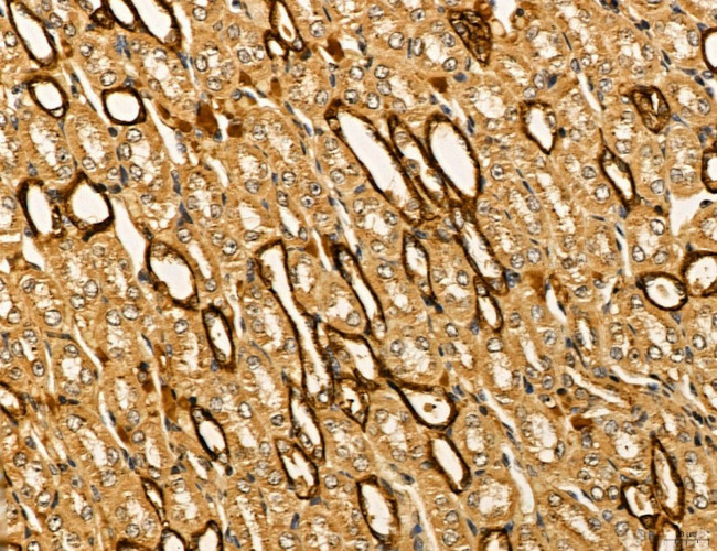 LIFR Antibody in Immunohistochemistry (Paraffin) (IHC (P))