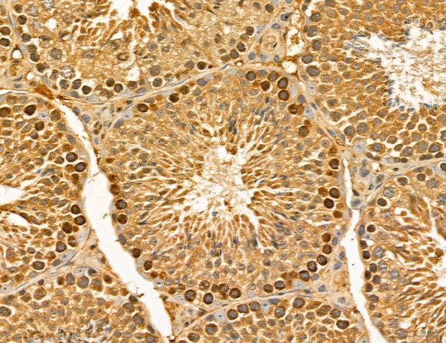 LIFR Antibody in Immunohistochemistry (Paraffin) (IHC (P))