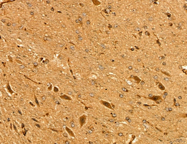 LIFR Antibody in Immunohistochemistry (Paraffin) (IHC (P))