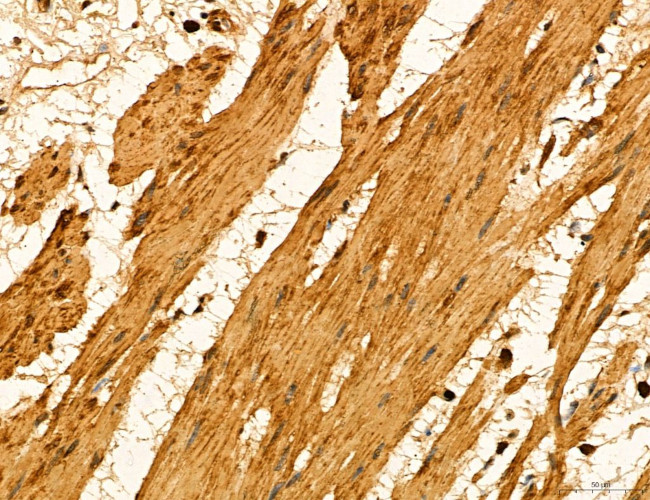 LIFR Antibody in Immunohistochemistry (Paraffin) (IHC (P))