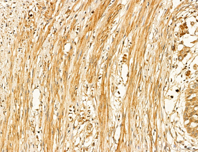 LIFR Antibody in Immunohistochemistry (Paraffin) (IHC (P))