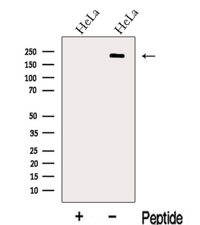 LIFR Antibody in Western Blot (WB)