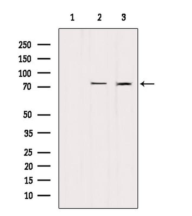 LIMK2 Antibody in Western Blot (WB)