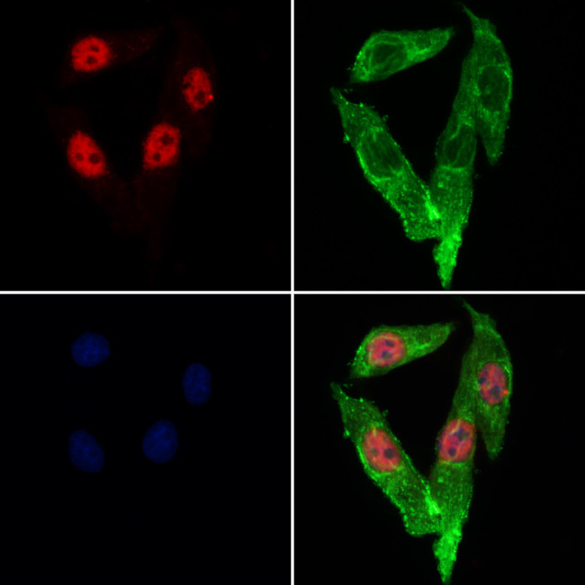 Lamin B2 Antibody in Immunocytochemistry (ICC/IF)