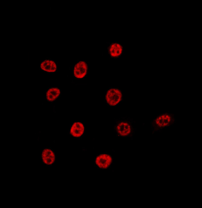 Lamin B2 Antibody in Immunocytochemistry (ICC/IF)