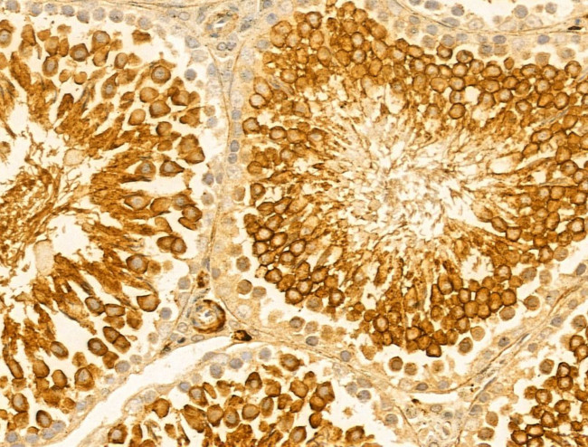 Lamin B2 Antibody in Immunohistochemistry (Paraffin) (IHC (P))