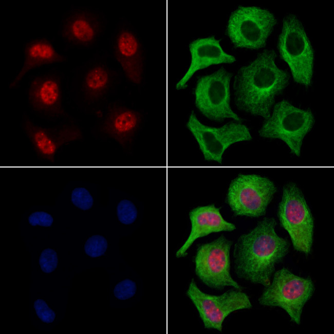 LMX1A Antibody in Immunocytochemistry (ICC/IF)