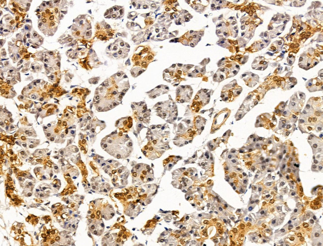 LMX1A Antibody in Immunohistochemistry (Paraffin) (IHC (P))