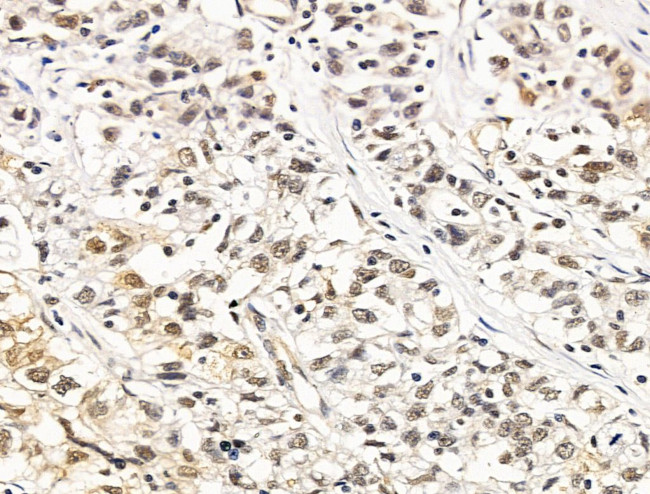 LMX1A Antibody in Immunohistochemistry (Paraffin) (IHC (P))