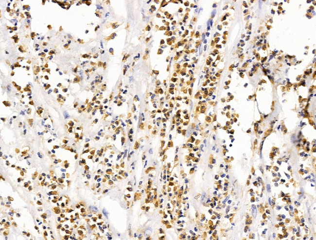 LMX1A Antibody in Immunohistochemistry (Paraffin) (IHC (P))