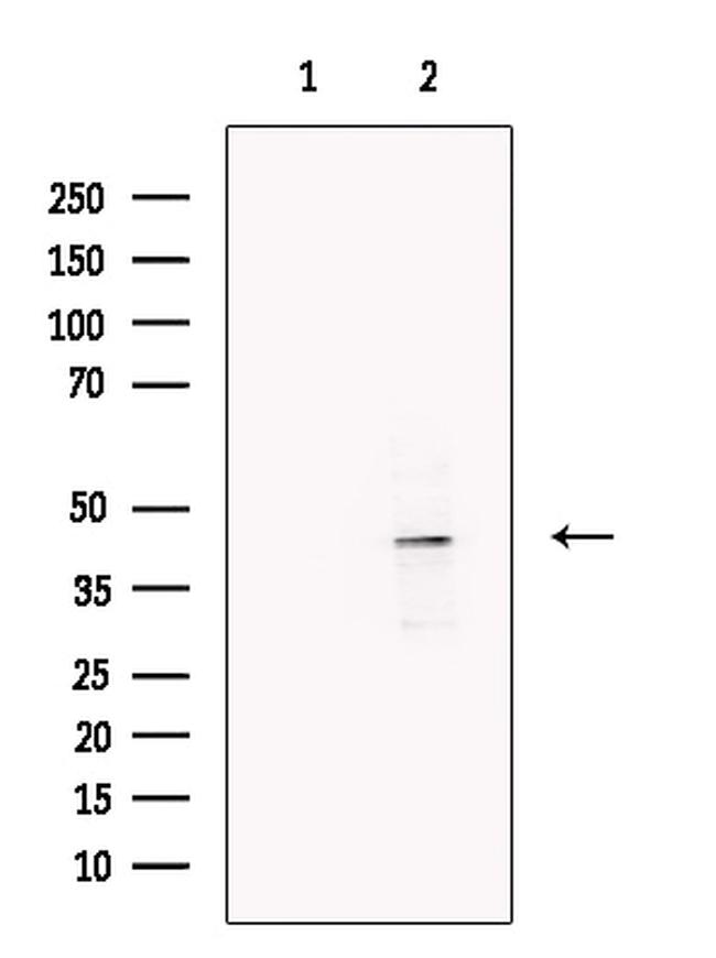 LMX1A Antibody in Western Blot (WB)