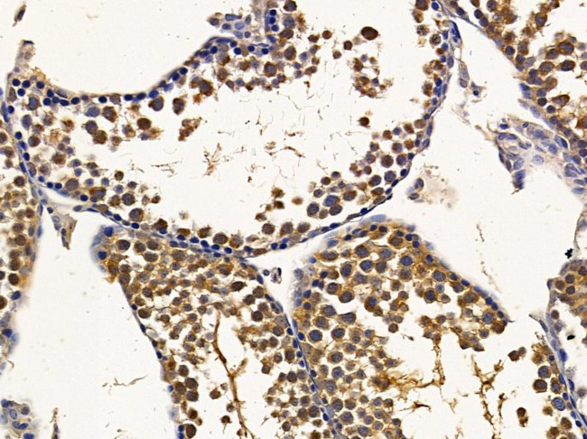 LOR Antibody in Immunohistochemistry (Paraffin) (IHC (P))