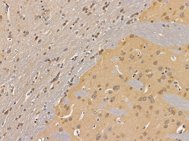 LOR Antibody in Immunohistochemistry (Paraffin) (IHC (P))