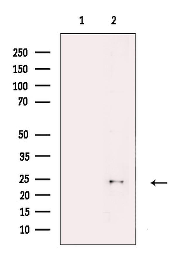 LOR Antibody in Western Blot (WB)