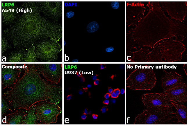 LRP6 Antibody in Immunocytochemistry (ICC/IF)