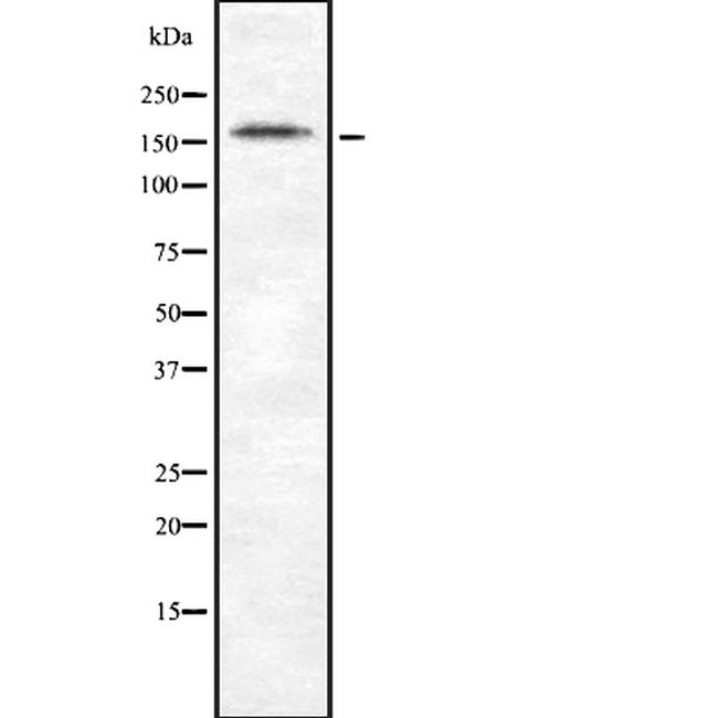 LRP6 Antibody in Western Blot (WB)