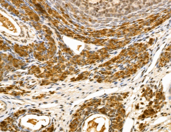 LZTFL1 Antibody in Immunohistochemistry (Paraffin) (IHC (P))