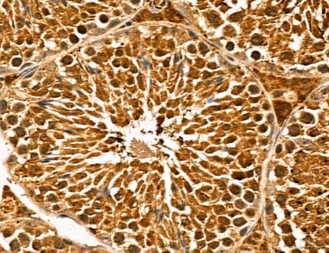 LZTFL1 Antibody in Immunohistochemistry (Paraffin) (IHC (P))