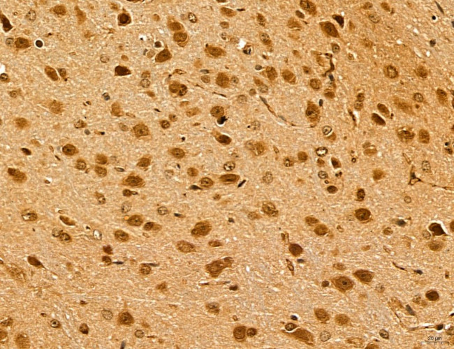 LZTFL1 Antibody in Immunohistochemistry (Paraffin) (IHC (P))